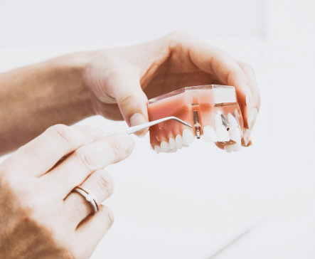 Prosthodontists Dentistry